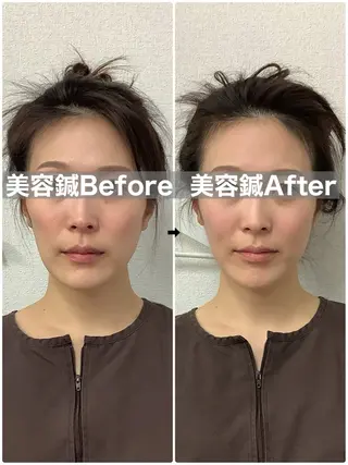 メディカルサロンドオフ所属・ハリサロンドオフ 美容鍼灸×小顔整体のエステ・リラクイメージ