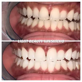 ライトビューティー 錦糸町店のエステ・リラクイメージ