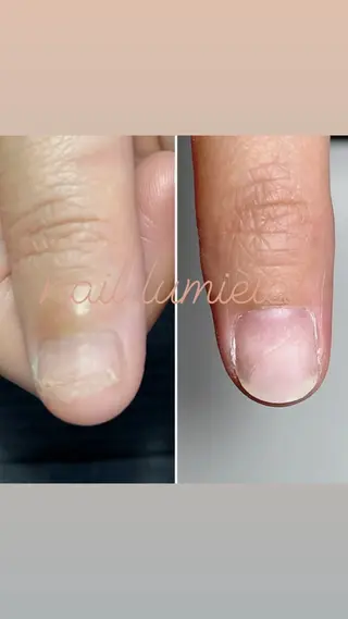 ネイル 深爪育成専門nail _Lumièlatのネイルデザイン