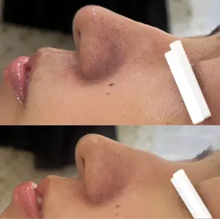 小顔&美肌品川店 Masqueradeのエステ・リラクイメージ