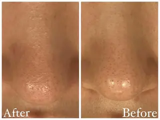 Brightplus ブライトプラスのエステ・リラクイメージ