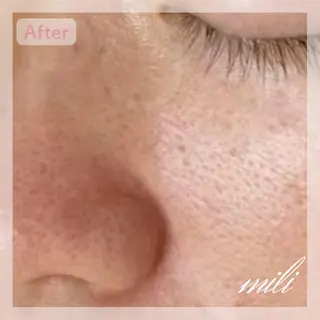 【毛穴ケア専門店✨】 mili 須藤歩華のエステ・リラクイメージ