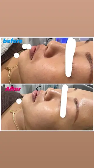 アルカンジュ~archange~所属・痩身/毛穴洗浄/脱毛 アルカンジュのエステ・リラクイメージ