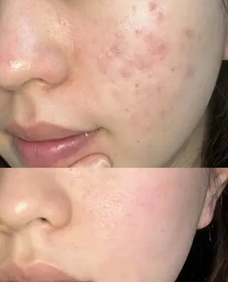 ネイル aliaハイフ&水光ジェットサロン所属・aliaハーブ水光店 エステティシャン募集のエステ・リラクイメージ