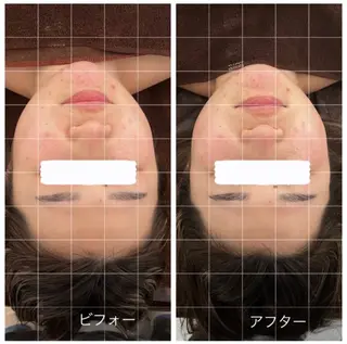 Relaxsalon undo所属・Relaxsalon undoのエステ・リラクイメージ