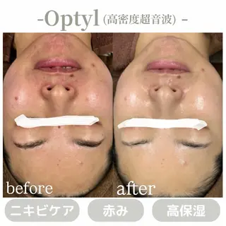 肌質改善|天王寺 For...はるかのエステ・リラクイメージ