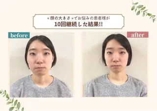 美容整体 小顔矯正 プラスフィール 平野のエステ・リラクイメージ