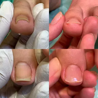 ネイル 東京巻き爪アカデミー所属・東京巻き爪 アカデミーのエステ・リラクイメージ