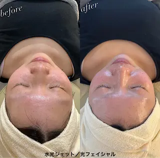 うなじ脱毛/美肌脱毛 LABELのエステ・リラクイメージ