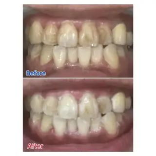 M渋谷店所属・M渋谷 ホワイトニングのエステ・リラクイメージ