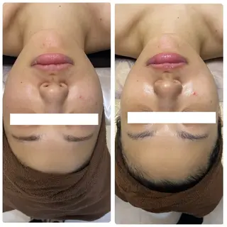 調律エステ /美KISSのその他イメージ