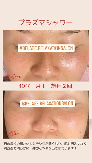 ベラージュ【美背中・ 美尻・フェイシャル】のエステ・リラクイメージ