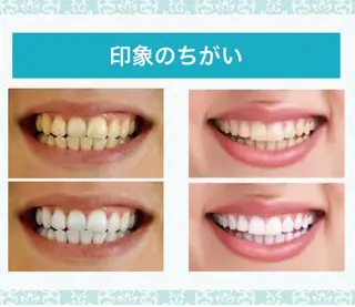 Shelly Graceのエステ・リラクイメージ