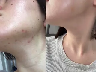 美容鍼サロン    Fleurir所属・伊藤 かなえのエステ・リラクイメージ