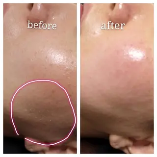 🅖🅤🅩🅔🅛 salonのエステ・リラクイメージ