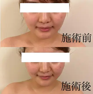 WOM SALON所属・MIKU【美容整形ダ ウンタイムケア銀座】のエステ・リラクイメージ