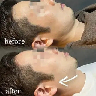 🪞Purasia. 🫧韓国肌管理💎のエステ・リラクイメージ