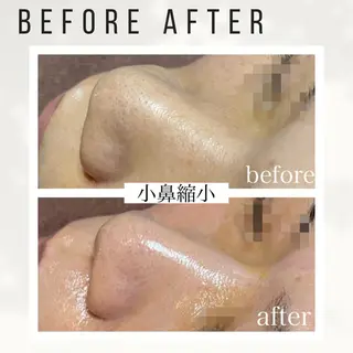 Beauty salon ハピー所属・大人女性のための 肌管理サロン　ハピーのエステ・リラクイメージ