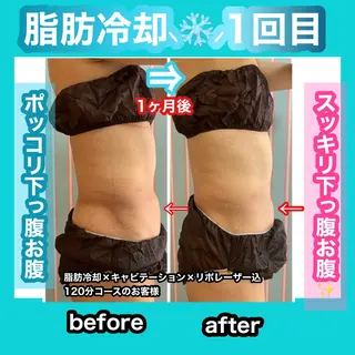 痩身/脱毛/ネイル HARUKAのエステ・リラクイメージ