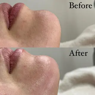 Rejue所属・永田 茜のエステ・リラクイメージ