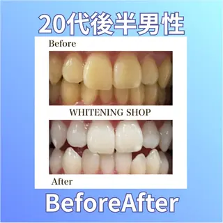 ホワイトニングショップ西原所属・下川 藍子のその他イメージ