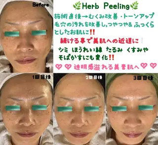 ヴィーナス ビューティーのエステ・リラクイメージ