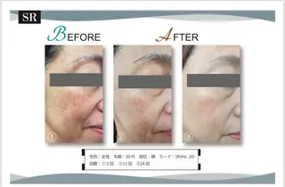 脱毛サロン　LILIAN所属・脱毛・美肌サロン LILIAN 脱石油のエステ・リラクイメージ