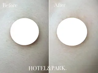 HOTEL&PARK . ワックス脱毛のエステ・リラクイメージ