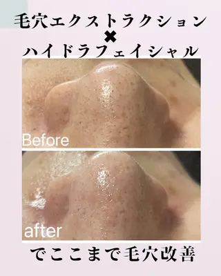 肌質改善サロン facialmoonのエステ・リラクイメージ