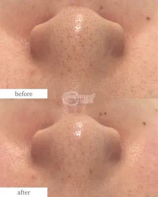 美の宝石屋さん gemme【ジェム】所属・gemme -ジェム-のエステ・リラクイメージ