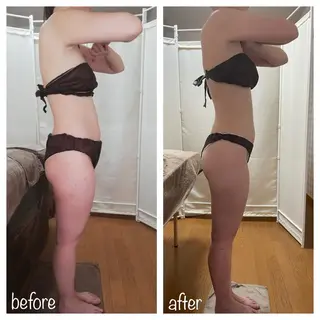 biloop所属・《痩身×疲労改善》 BILOOPのエステ・リラクイメージ