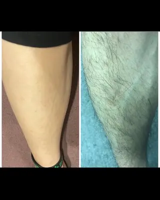 メンズ men's cool 【メンズ脱毛サロン】のエステ・リラクイメージ