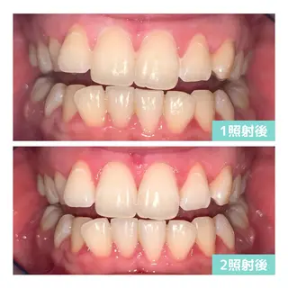 ホワイトニング｜韓国式3D毛穴洗浄 lonhana ﾛﾝﾊﾅ所属・韓国式3D毛穴洗浄 lonhanaのその他イメージ