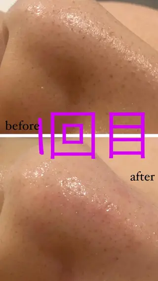 アルカンジュ~archange~所属・痩身/毛穴洗浄/脱毛 アルカンジュのエステ・リラクイメージ