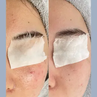 Lien ~beauty salon~所属・福島⌇毛穴専門サロン ⌇﻿モニター募集のエステ・リラクイメージ