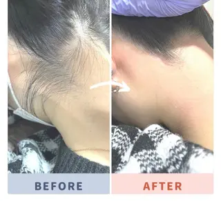 ミディアム ヘアアレンジ メンズ 河上★うなじや首回り Wax脱毛が得意ですのエステ・リラクイメージ