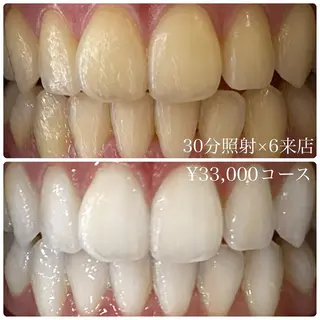 PLATINUM Beauty 横浜店所属・ホワイトニングルーム 横浜店のその他イメージ