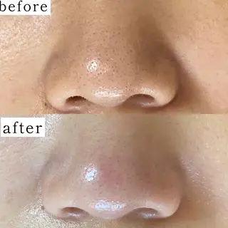 毛穴専門サロン　フルール所属・フルールFululu 自由が丘のエステ・リラクイメージ