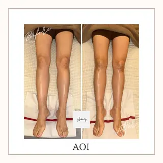 salon shares 辻堂店所属・SHARES AOIのエステ・リラクイメージ