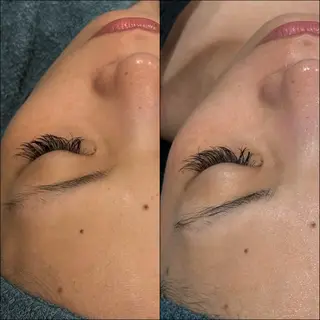 LiZA エステティックサロンのエステ・リラクイメージ