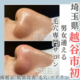 脱毛MAX南越谷所属・脱毛MAX 店長まなみのエステ・リラクイメージ