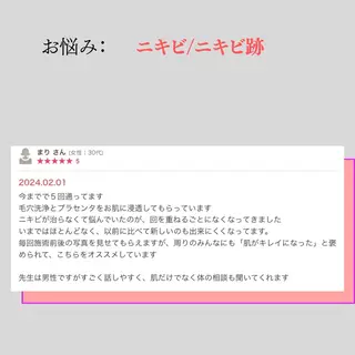 小顔・ツルツル素肌 ハリステリアのエステ・リラクイメージ