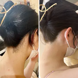 うなじ脱毛/美肌脱毛 LABELのエステ・リラクイメージ