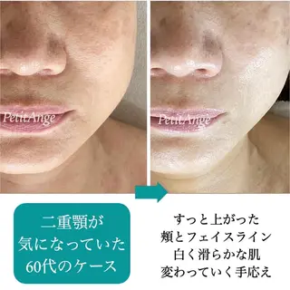 プチアンジェ所属・艶肌&小顔リフト❤︎ プチアンジェ茅ヶ崎のエステ・リラクイメージ