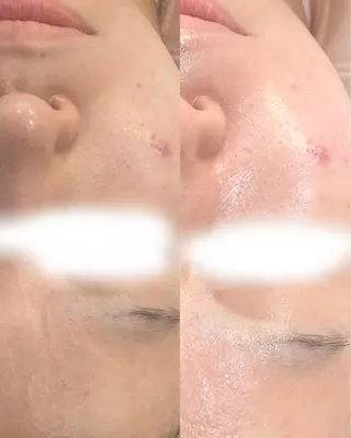 abbellina×UNO出雲塩冶店《ウノ》所属・フェイシャルエステ 🫧琉衣のエステ・リラクイメージ