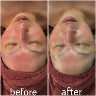 中目黒  整体 小顔 KUOKOAのエステ・リラクイメージ