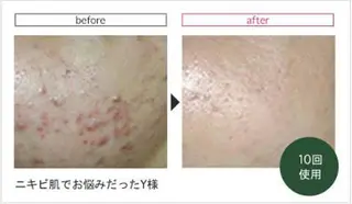 ハーブピーリング専門 muro.のエステ・リラクイメージ