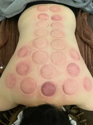 美容鍼/鍼灸 ここみ鍼灸院のエステ・リラクイメージ