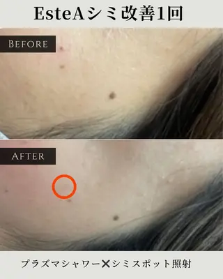 シミ毛穴|眉Wax THE  flowのエステ・リラクイメージ