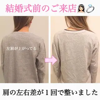 小顔モニター 募集のエステ・リラクイメージ